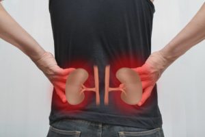 Kidney Pain